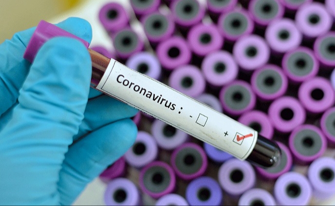 عاجل.. تسجيل حالتين جديدتين بكورونا بسيدي علي بنحمدوش يرفع الحصيلة الى 15 حالة مؤكدة بإقليم الجديدة