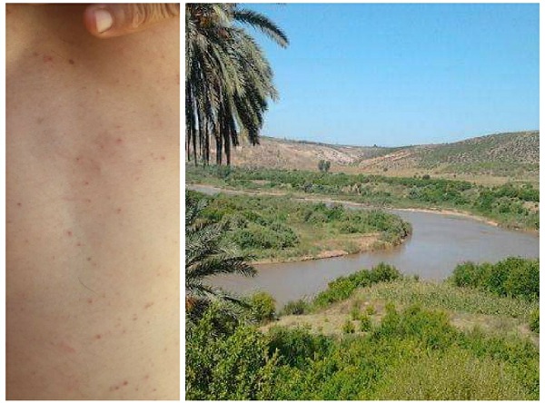 حشرة 'مجهولة'' تجتاح منطقة امهيولة قرب نهر أم الربيع