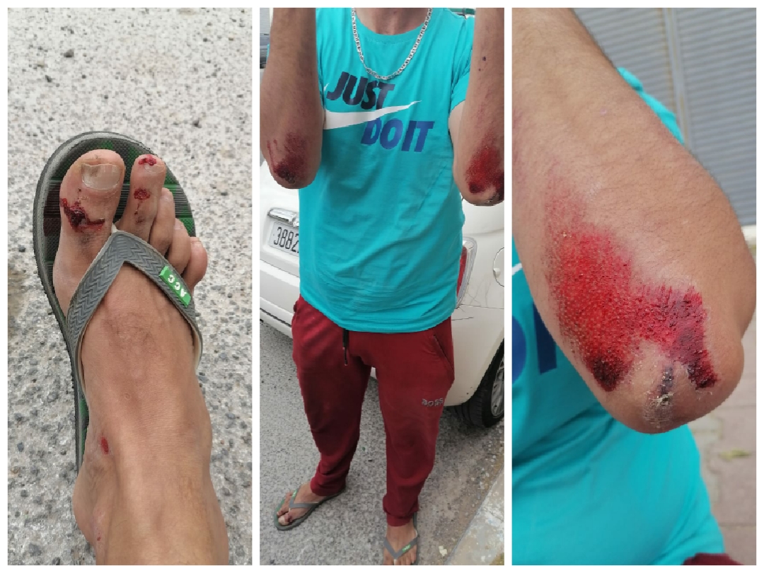 سيارة تدهس مواطنا  وتلوذ بالفرار بشارع جبران خليل جبران بمدينة الجديدة