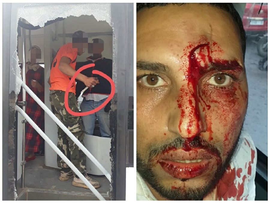 بالصور.. اعتداءات شنيعة على عمال شركة النقل الحضري بالجديدة