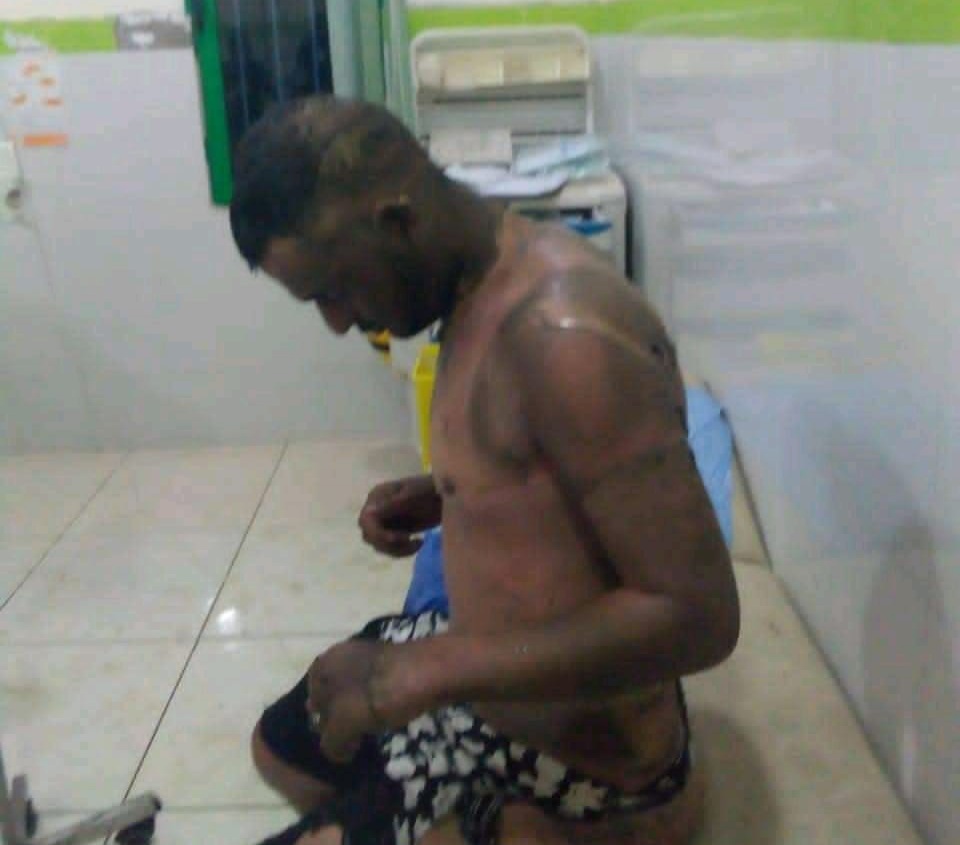 صادم.. شاب يضرم  النار في جسده أمام ملحقة إدارية بسيدي بنور