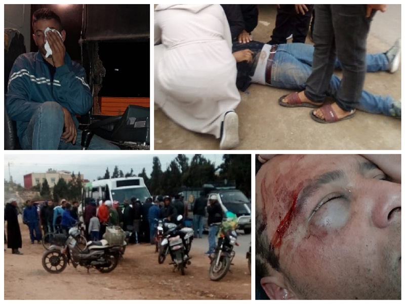 إصابة سائقي حافلتين للنقل الحضري بالجديدة في اعتدائين اجراميين منفصلين