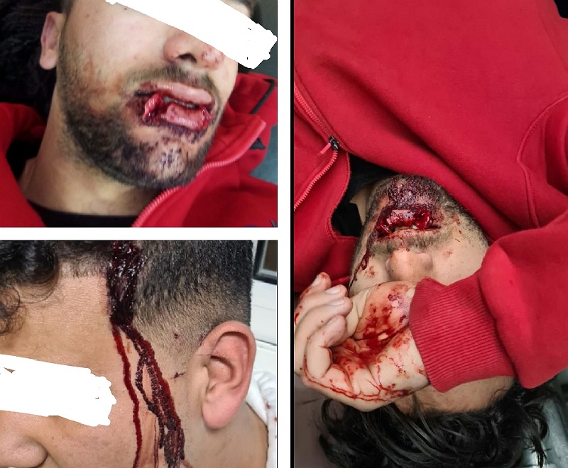 الاعتداء على شقيقين بالسلاح الأبيض في حي السلام بمدينة الجديدة