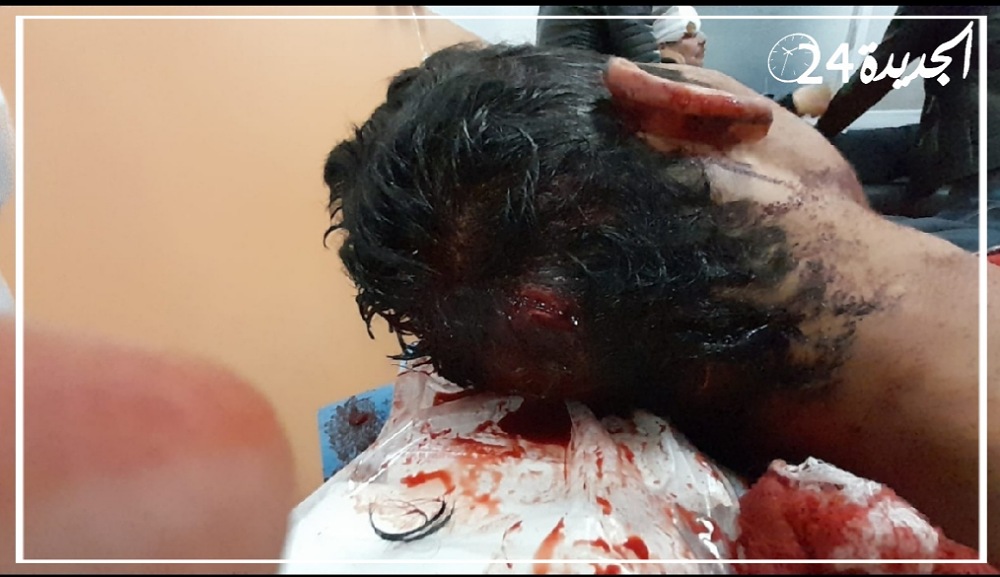 نجاة طالب شاب من موت محقق بعد الاعتداء عليه بواسطة السيوف بوسط الجديدة