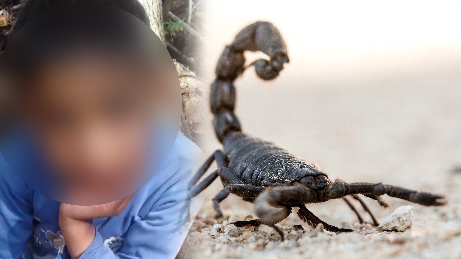 جماعة أولاد حمدان : وفاة طفلة متأثرة بلدغة عقرب