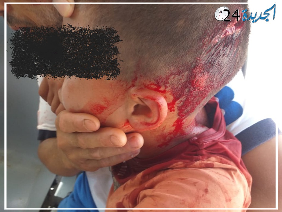 بالصور.. اصابة طفل بجروح خطيرة بعد اعتداء شنيع على حافلة للنقل الحضري بالجديدة