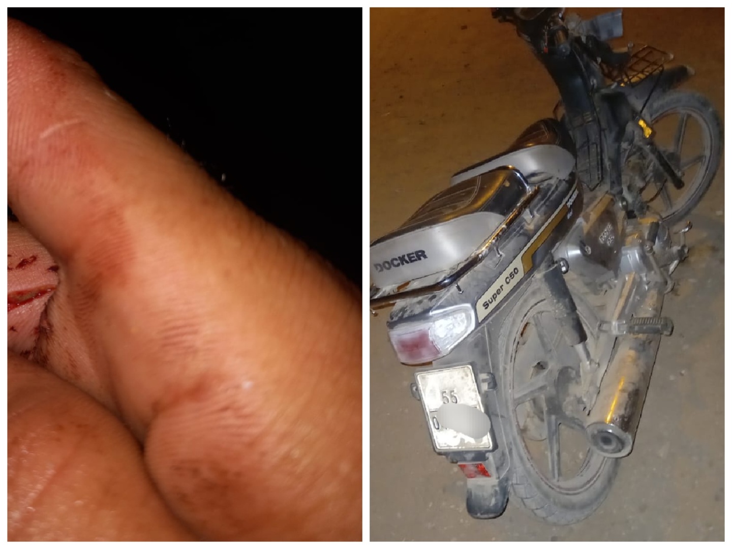 البحث عن مجرم خطير متورط في الاعتداء بالسلاح الابيض على مقاول شاب في حي المطار بالجديدة