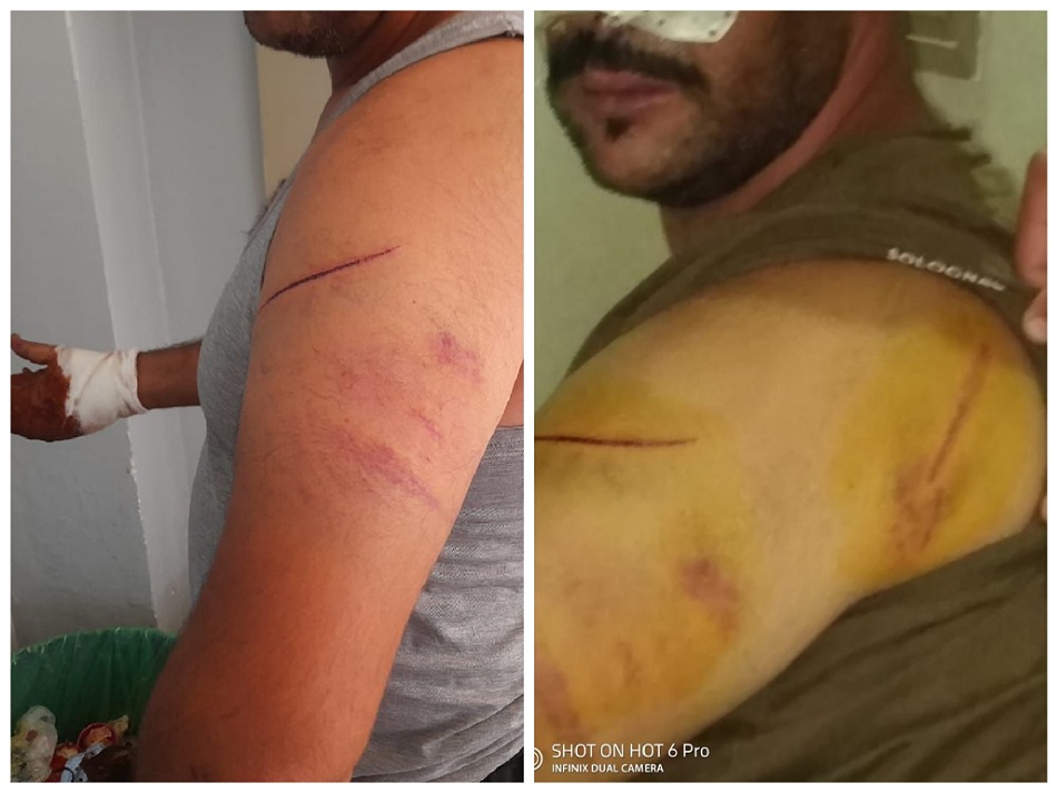 أمن الجديدة يسارع الزمن لإيقاف مجرم خطير متورط في جريمة محاولة قتل بدوار الطاجين