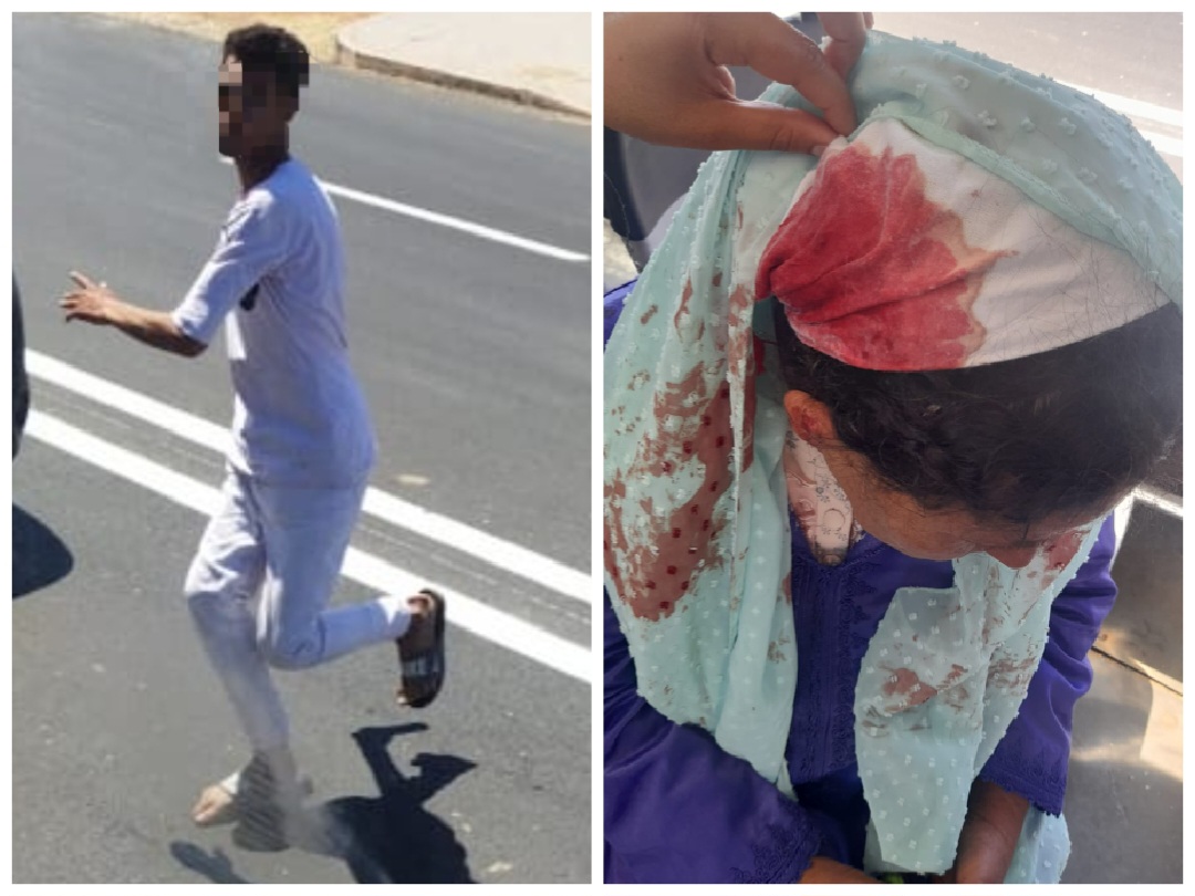 جانح يهاجم حافلة للنقل الحضري بالجديدة ويرسل سائقها وأحد الركاب إلى قسم المستعجلات