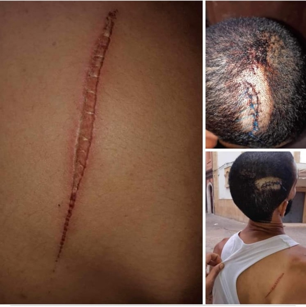 ايقاف مجرم خطير اعتدى على مجموعة من المواطنين الأبرياء بالجديدة