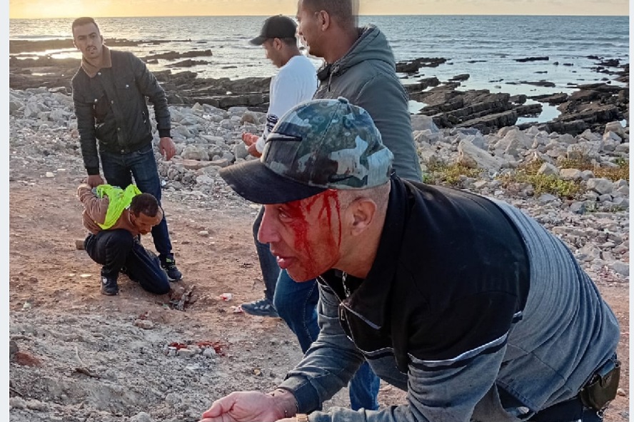 اعتداء على عنصر أمني بالجديدة من طرف شخص يرتدي 'جيلي أصفر' بشارع النصر