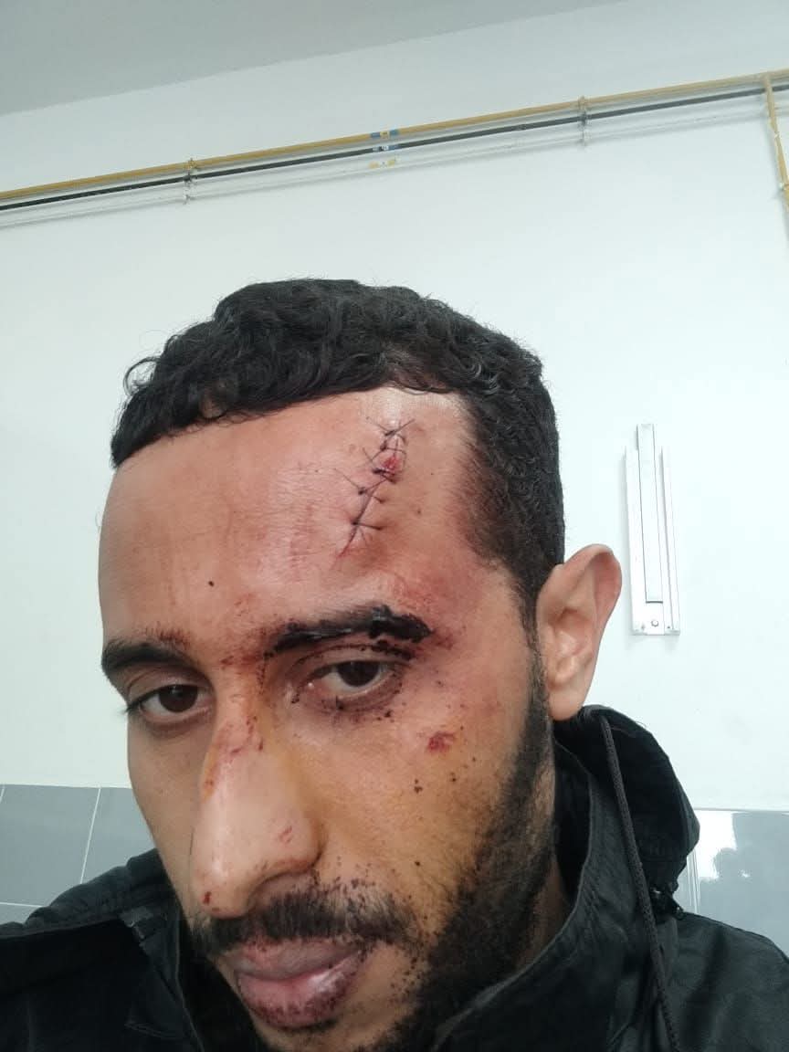 الاعتداء على إمام بالسلاح الأبيض بدوار المنادلة… جريمة تهز القيم وتستفز الضمير الجماعي بالجديدة