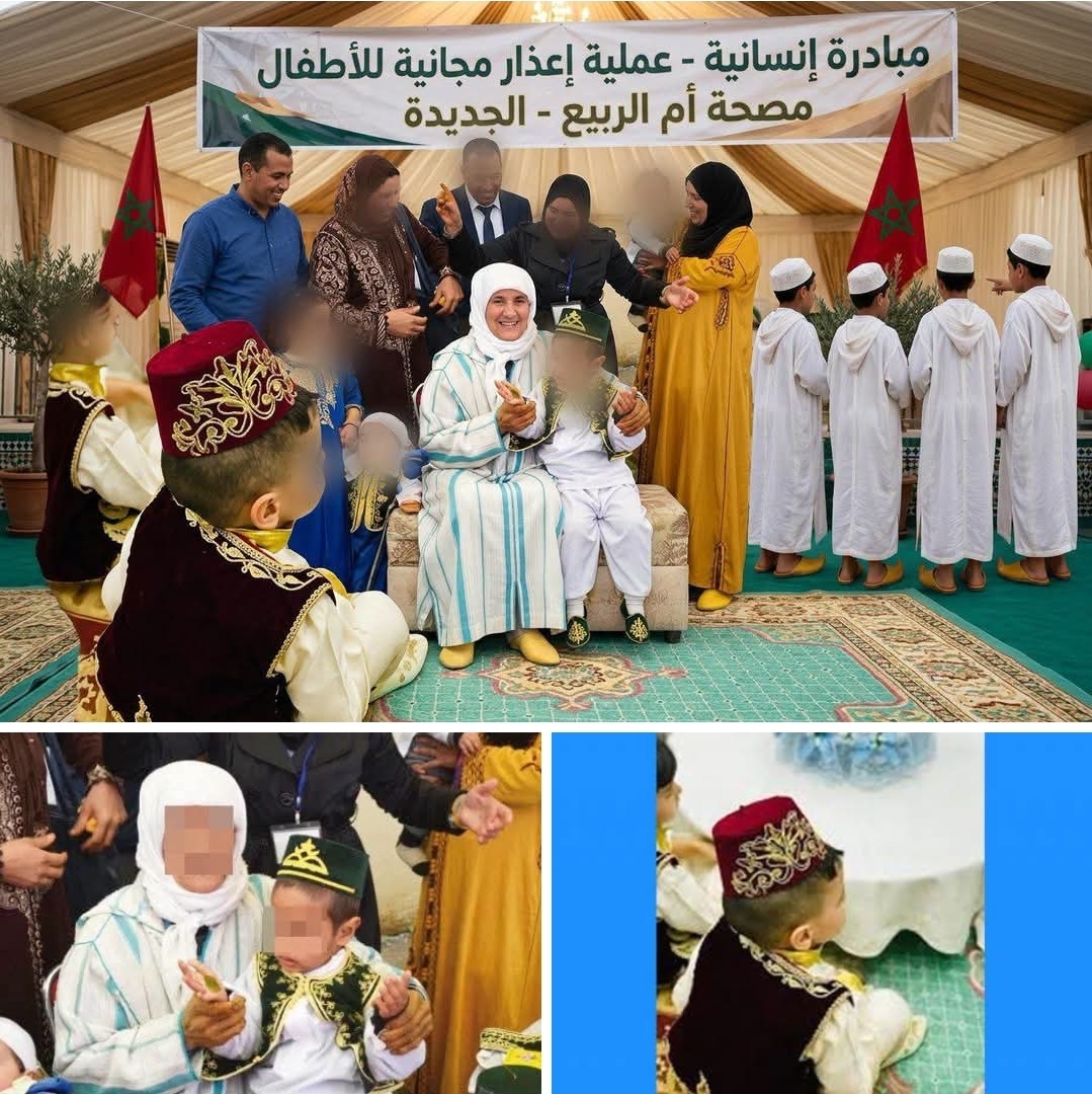 جمعية الملكي للخدمات الإجتماعية تنظم عملية إعذار مجانية للأطفال بالجديدة